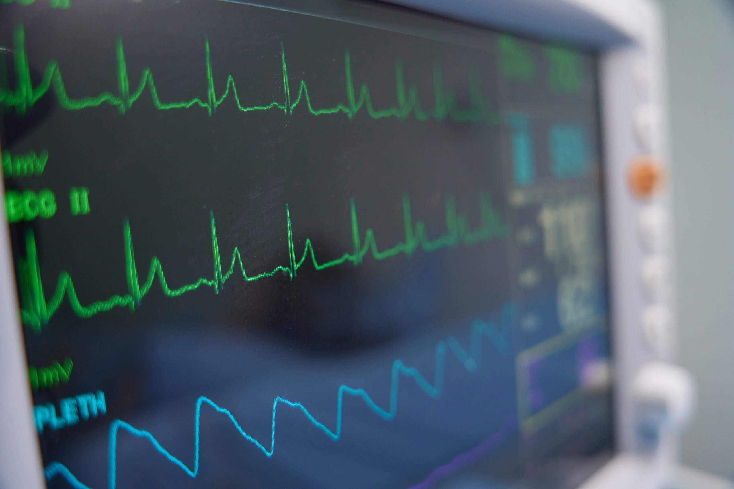 Bedside Patient Monitors